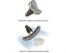 Arthrosurface Knee HemiCAP systems | Which Medical Device
